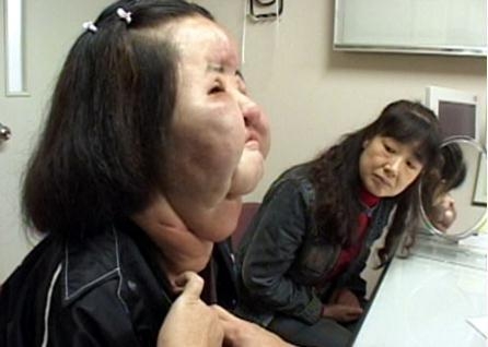 「电风扇大妈」整形失败,离世享年57岁,人生短短,别强求